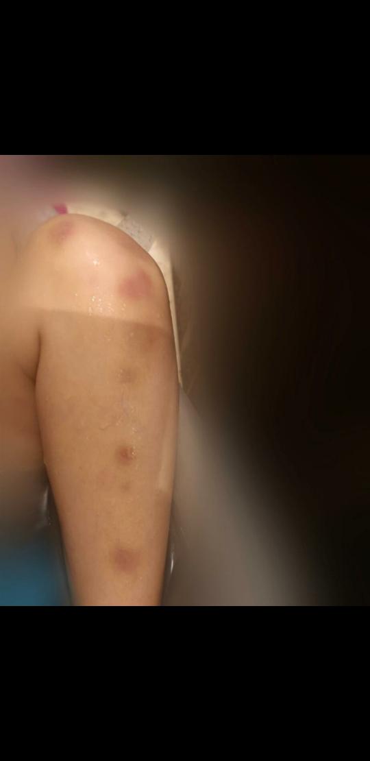 AdelaVanucci's tweet photo. ⚠️🚨 THREAD A RT SVP !! 
UNE ENFANT DE 3 ANS EN DANGER !! 🚨⚠️
Déjà 2 SIGNALEMENTS depuis janvier 2020 contre un père/mari VIOLENT, la justice vient de lui accorder une GARDE ALTERNÉE !
Léa 3 ans, passe de 24h/mois sans hébergement chez son père à une garde alternée 15Jrs/15Jrs⬇️ https://t.co/3jScuQYgwE