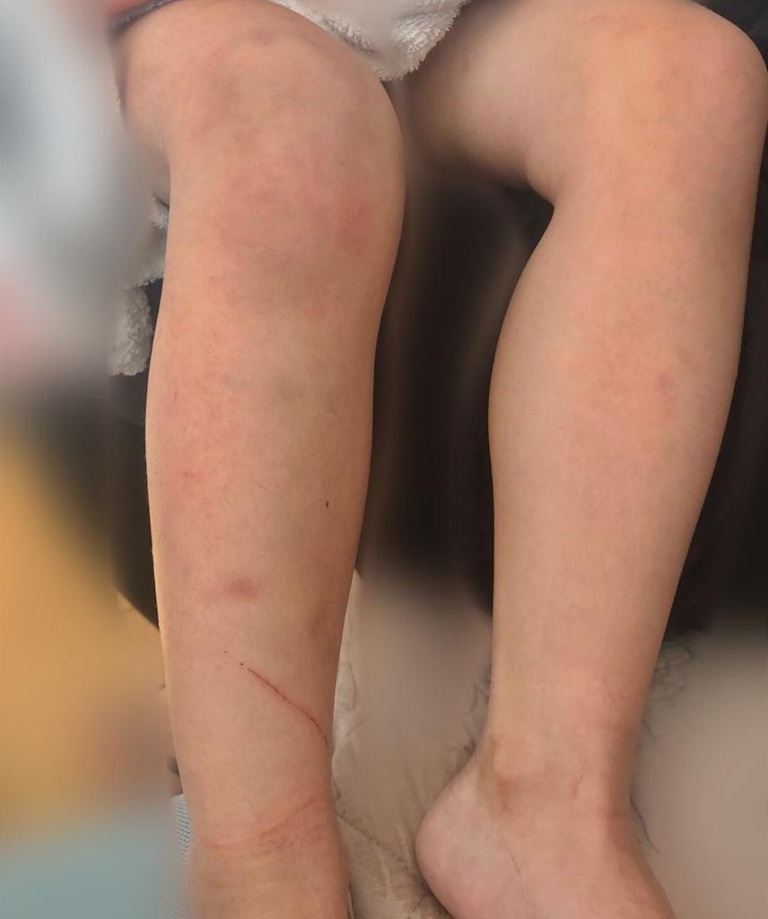 AdelaVanucci's tweet photo. ⚠️🚨 THREAD A RT SVP !! 
UNE ENFANT DE 3 ANS EN DANGER !! 🚨⚠️
Déjà 2 SIGNALEMENTS depuis janvier 2020 contre un père/mari VIOLENT, la justice vient de lui accorder une GARDE ALTERNÉE !
Léa 3 ans, passe de 24h/mois sans hébergement chez son père à une garde alternée 15Jrs/15Jrs⬇️ https://t.co/3jScuQYgwE