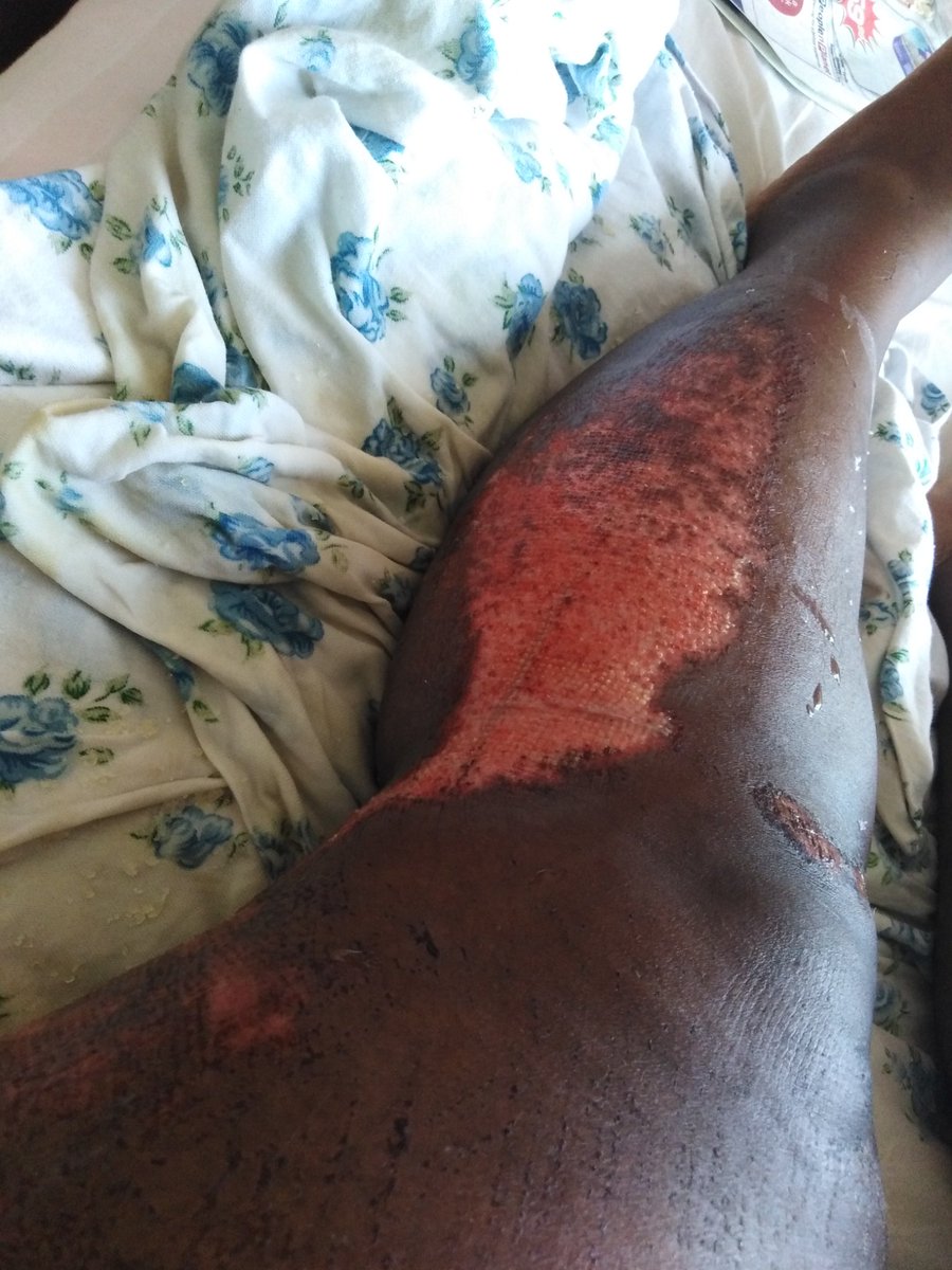 Monica40449774's tweet photo. He drove over me &amp; my mom multiple times and went to burn our flat and i have nothing left. This is all because, i ended the relationship. 😭😭😭😭 https://t.co/Mb7x8Lc8w1