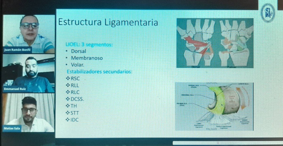 CirugiaManoMIMC's tweet photo. Síndrome de Impactación Cubital por el Dr. Emmanuel Ruíz (@ruizhands) y Capsulodesis de Muñeca por el Dr. Matías Sala (@matisala5) por el canal de #YouTube de la Asociación Mexicana de Cirugía de la Mano. Link: https://t.co/AJROlrFiSm https://t.co/vHCIywQhc0