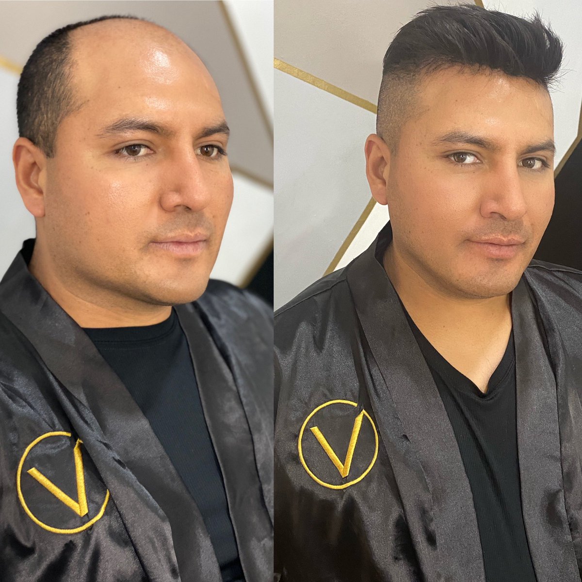 VicoGuadarrama's tweet photo. Cabello en 30 minutos con #ProtesisCapilar inf 51623857 https://t.co/Kr8LdZmRzK