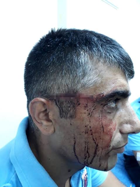 Bu İnfaz ve Koruma Memuru arkadaşımız Bilgisayar başında çalışırken yaralandı! "Güvenlik Hizmetleri Sınıfı" istiyoruz! #CezaeviPersonelininTalepleri