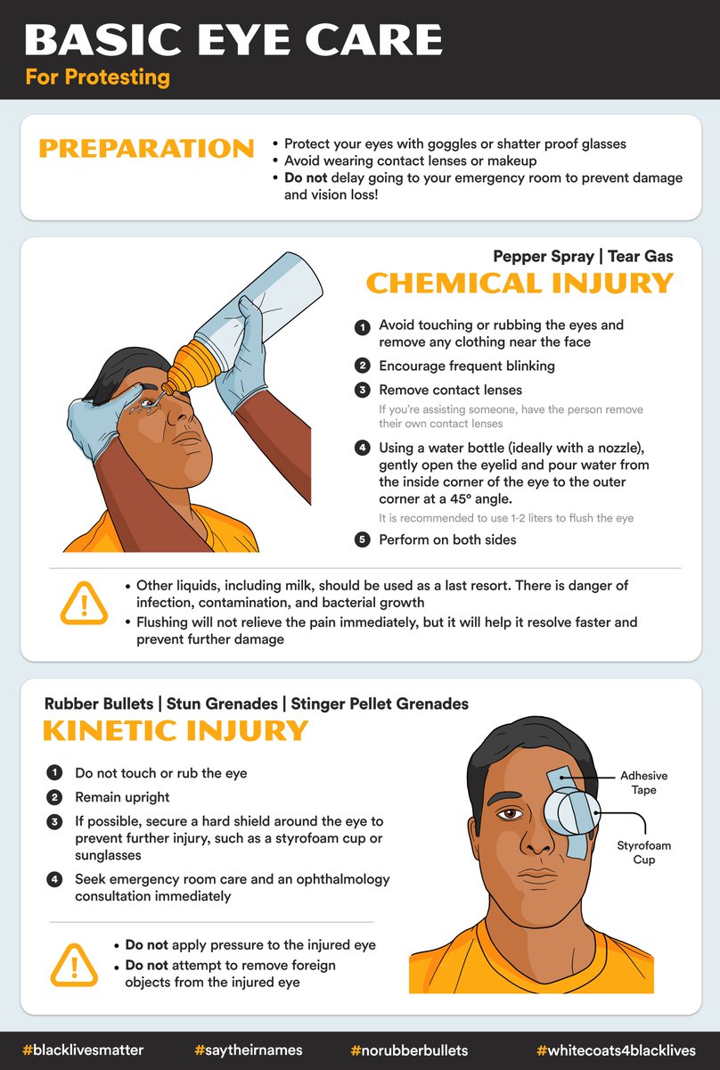 ameeazad's tweet photo. Protesters! @_ryanbrewster_  and I made a visual guide on basic eye care when facing police aggression. In line with 
@aao_ophth &amp; @DoNoHarmUCSF recs. See you in the streets and stay safe.

#BlackLivesMatter #NoRubberBullets #MedTwitter #MedStudentTwitter #GeorgeFloydProtests https://t.co/8iCGXeDuT3
