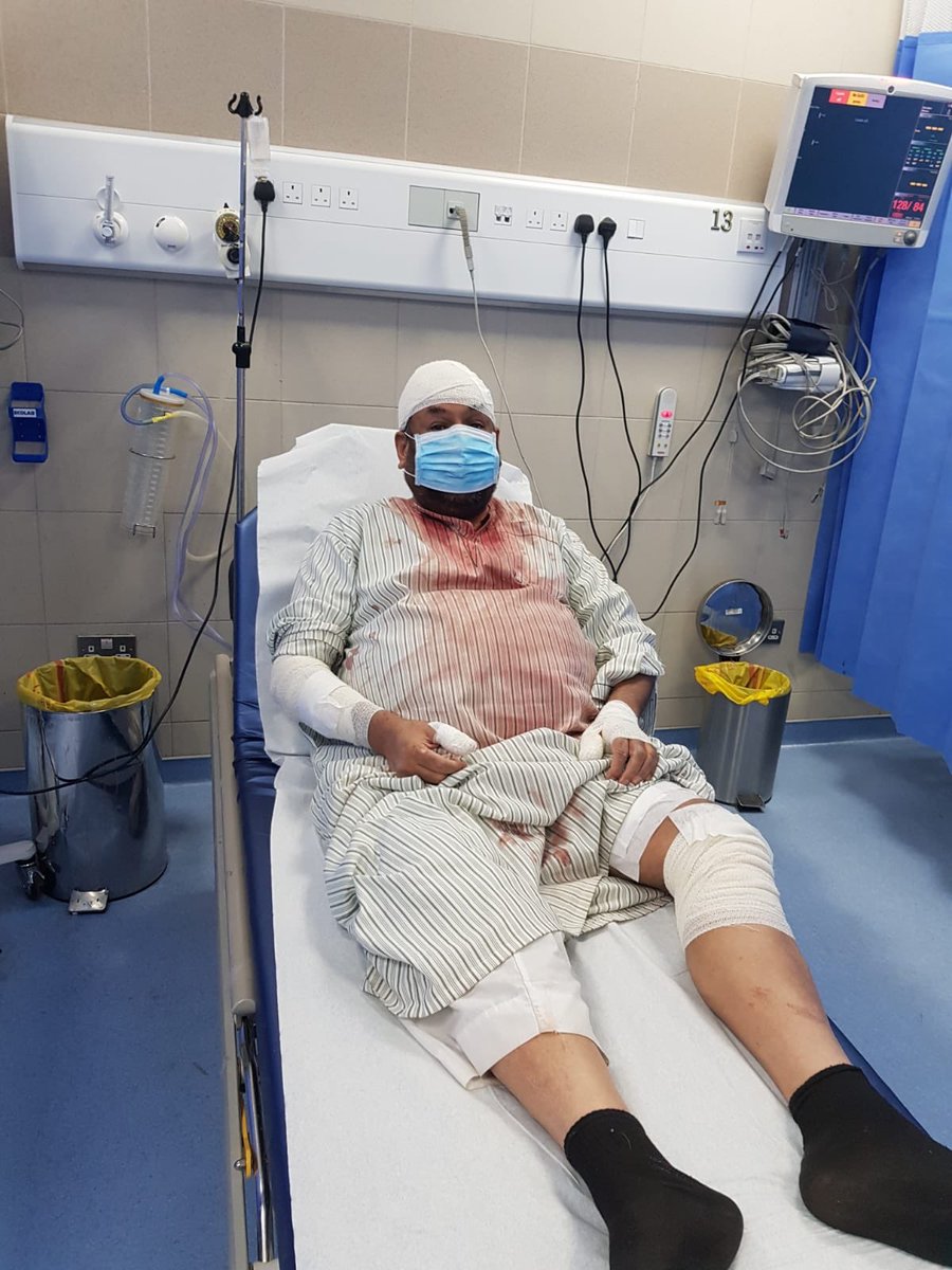 dr_khalfan's tweet image. قبل شوي خرجت من مستشفى مبارك ولله الحمد على عنايته في حالة يرثى لها، بعد ان هاجمني كلب بوليسي للجار هجوماً شرساً قاسيا ولولا لطف الله لكنت ميتاً.ونقلت الى المستشفى في نزيف شديد في عدة أماكن في جسمي.ياناس اللي تربون كلاب في البيوت هذه جرائم قتل #وزارة_الداخلية لازم تتشدد @Moi_kuw