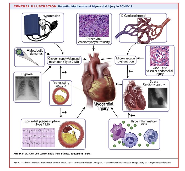 INJURIA MIOCARDICA en #COVID19

Revisión imperdible  <a href="/JACCJournals/">JACC Journals</a> desde la virología básica hasta las manifestaciones 💔
#cardiotwitter #FOAMed 
basictranslational.onlinejacc.org/content/5/5/518