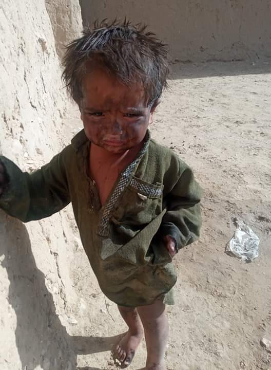 IrfanZehri100's tweet photo. لنگڑی بینگُنی بے وسی زندگی
تارمئی بے تغی ای و نی زندگی😣
#درنیلی
#Hadirkash #Zehri
#Balochistan https://t.co/sLwmCwLoFG