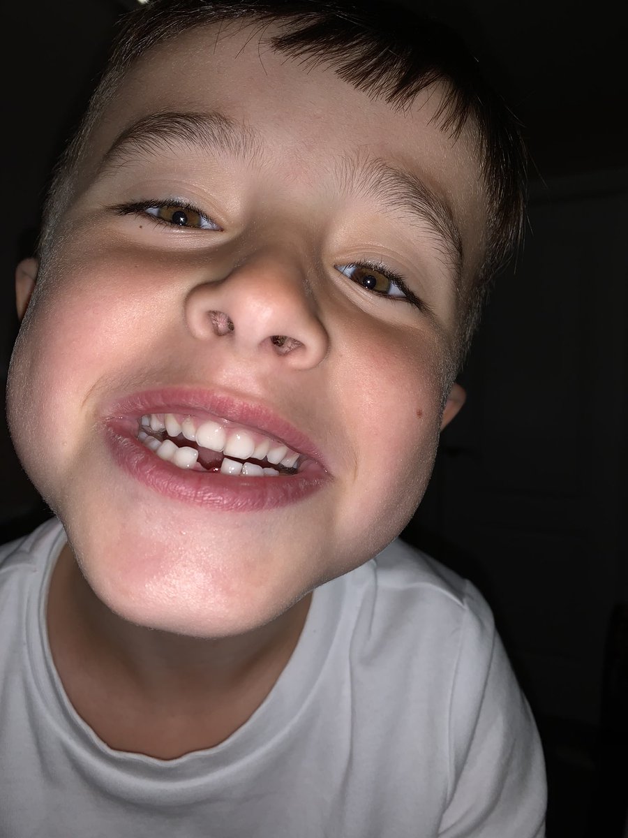 TM_22_14's tweet photo. Never seen him so excited #firsttoothout https://t.co/y520wwySun