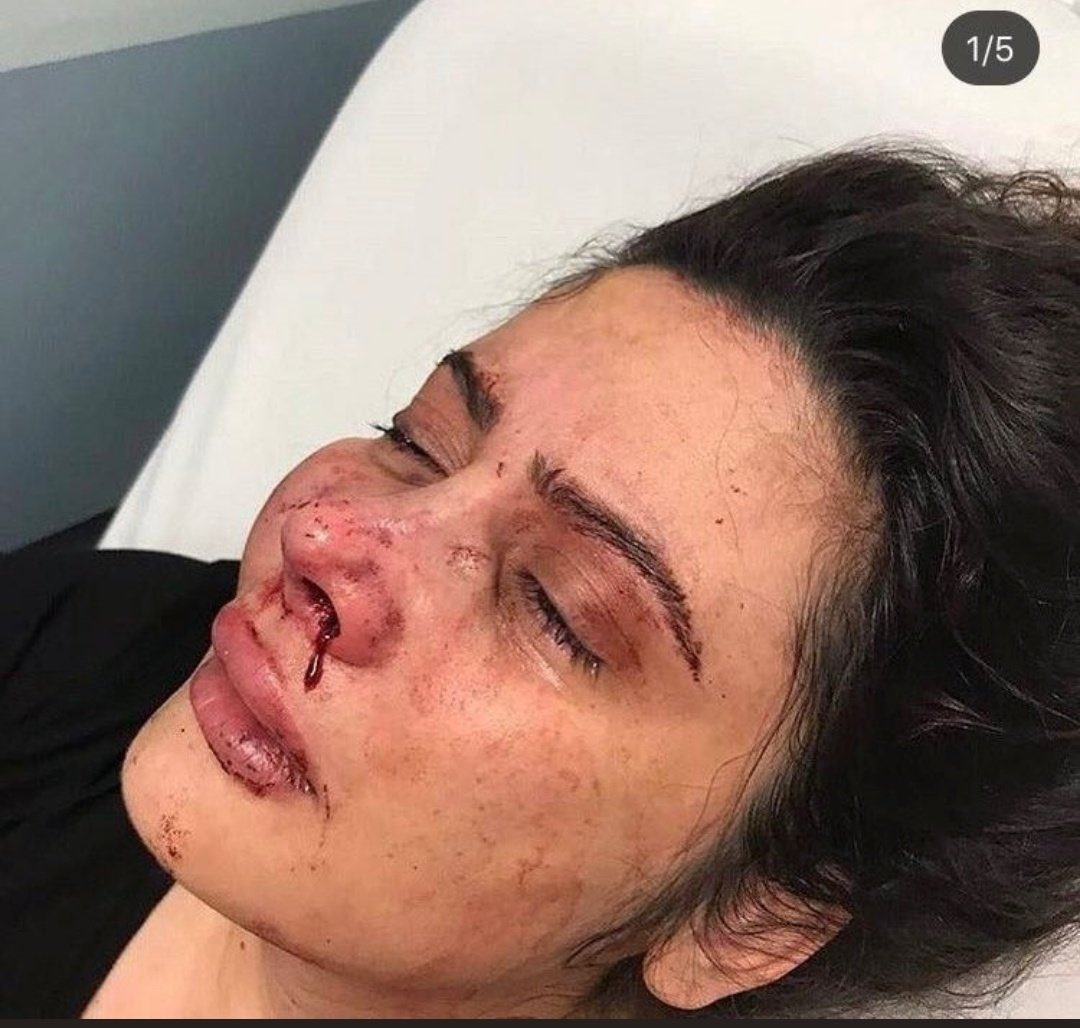 gnlnarr's tweet photo. Daha kaç kadın böyle katledilecek? Daha kaç kadına sessiz kalınacak? Korumaya çalışanlar 18 yılla yargılanırken, takım elbise giyip önünü ilikledi diye daha kaçına cezai indirim uygulanacak?! Birileri artık şunları durdursun! #erolelbasantutuklansın https://t.co/XyOPexdxxu