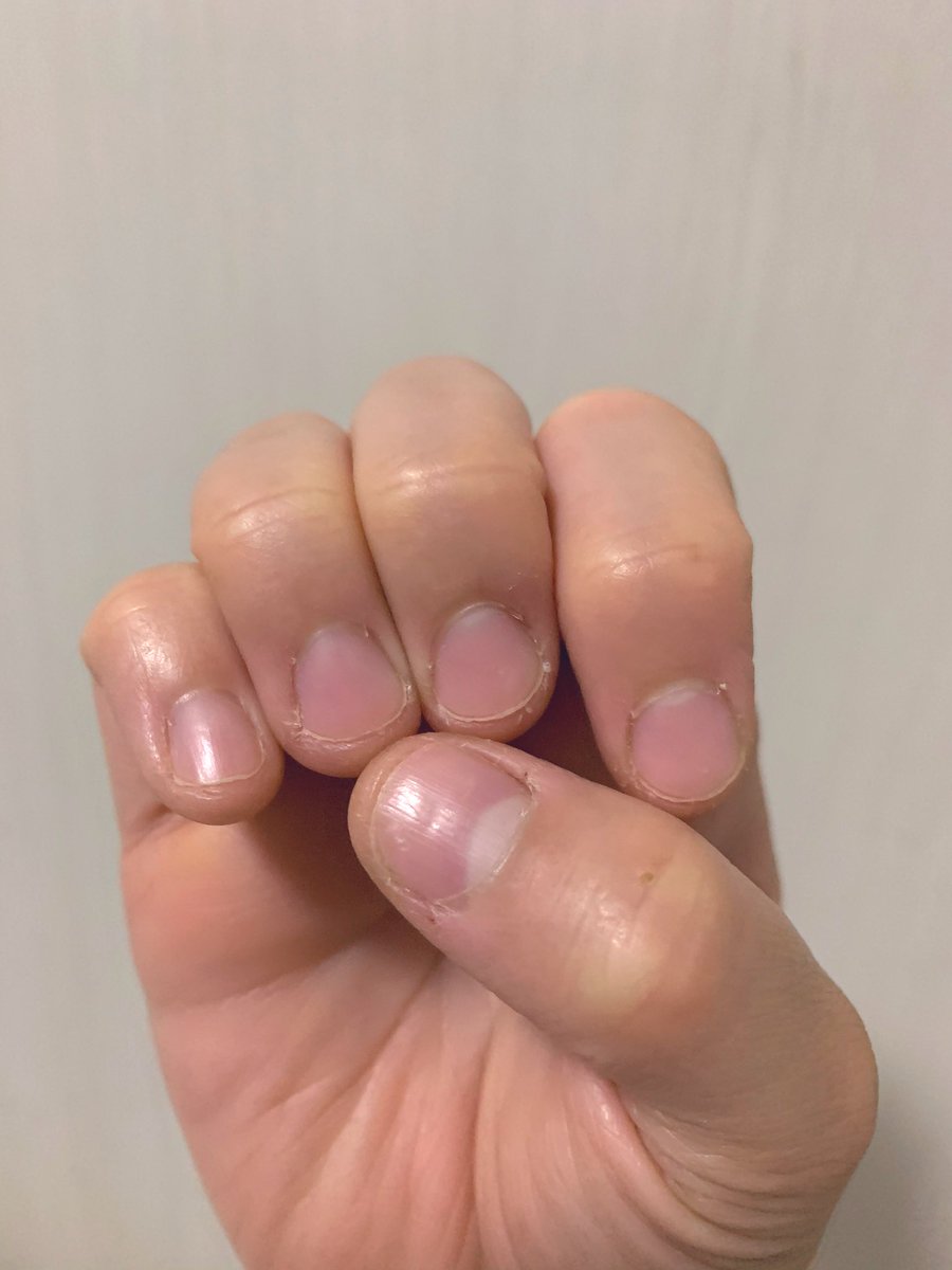 ぺちゃ 育爪垢 A8409 Twitter