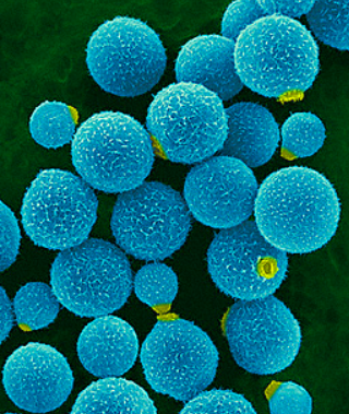 11/One unique feature of cryptococcus is the large size of the fungus itself.Cryptococcus (a yeast) is 30 um in diameter, much larger than other yeast such as candida (10 um) or histoplasma (4 um). https://www.sciencedirect.com/science/article/pii/B9781455706952000298