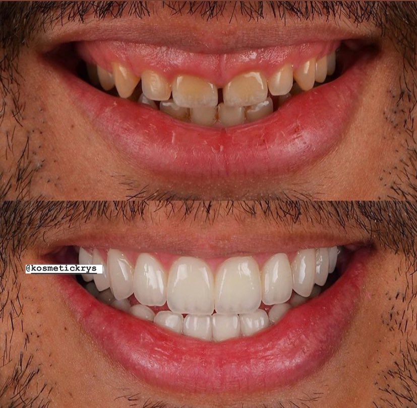 PLASTIC SURGERY CONSULTANT on Twitter "Correction of those cheap