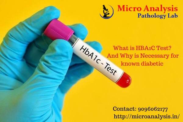 PahologyLab's tweet photo. HbA1C 
https://t.co/8aBndqrppd https://t.co/JIuQuNqoHo #hemoglobin #anemia #medicine #iron #blood #f #n #s #health #vitaminb #easytouch #science #usmle #hb #k #sicklecellawareness #diabetes #eritrosit #redbloodcell #hematology #in #sicklecell #ironsupplements #healing #medical https://t.co/AyIozXyf7H