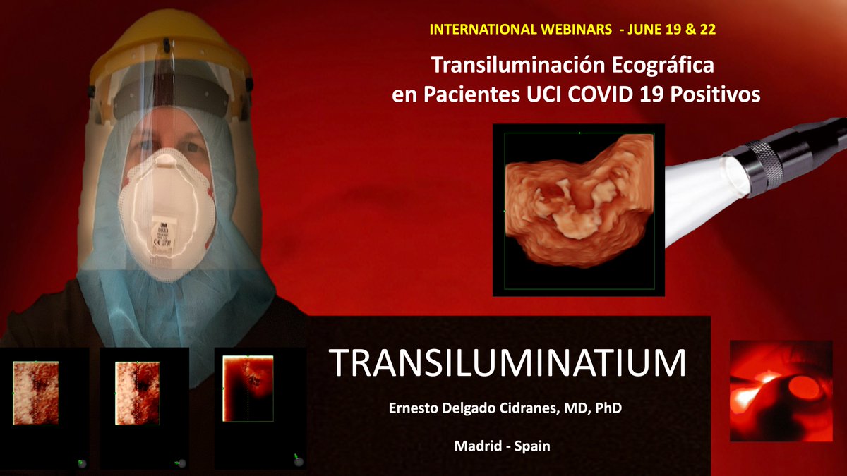 USAnesthesia's tweet image. Transillumination: High technology / WEBINARS
One more step in optimizing the Critical Ultrasound Image
.
Webinar for Mexico RECAT June 19 (Spanish) 10:00 h México
Webinar for USA WCS June 22 (English) 13:00 h USA
.
#POCUS #transilumination #advancedultrasound #CriticalCare