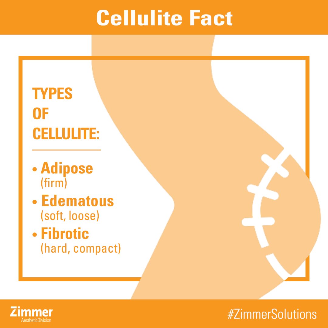 Zimmer_USA's tweet photo. Types of #cellulite: #adipose (firm), #edematous (soft, loose) and #fibrotic (hard, compact). Zimmer #ZWave Radial Pulse Technology is #FDA cleared to treat cellulite. It is #noninvasive, #painless &amp; offers visible #results! #CelluliteFacts #CelluliteFact #ZimmerSolutions https://t.co/oU2LA43pvf