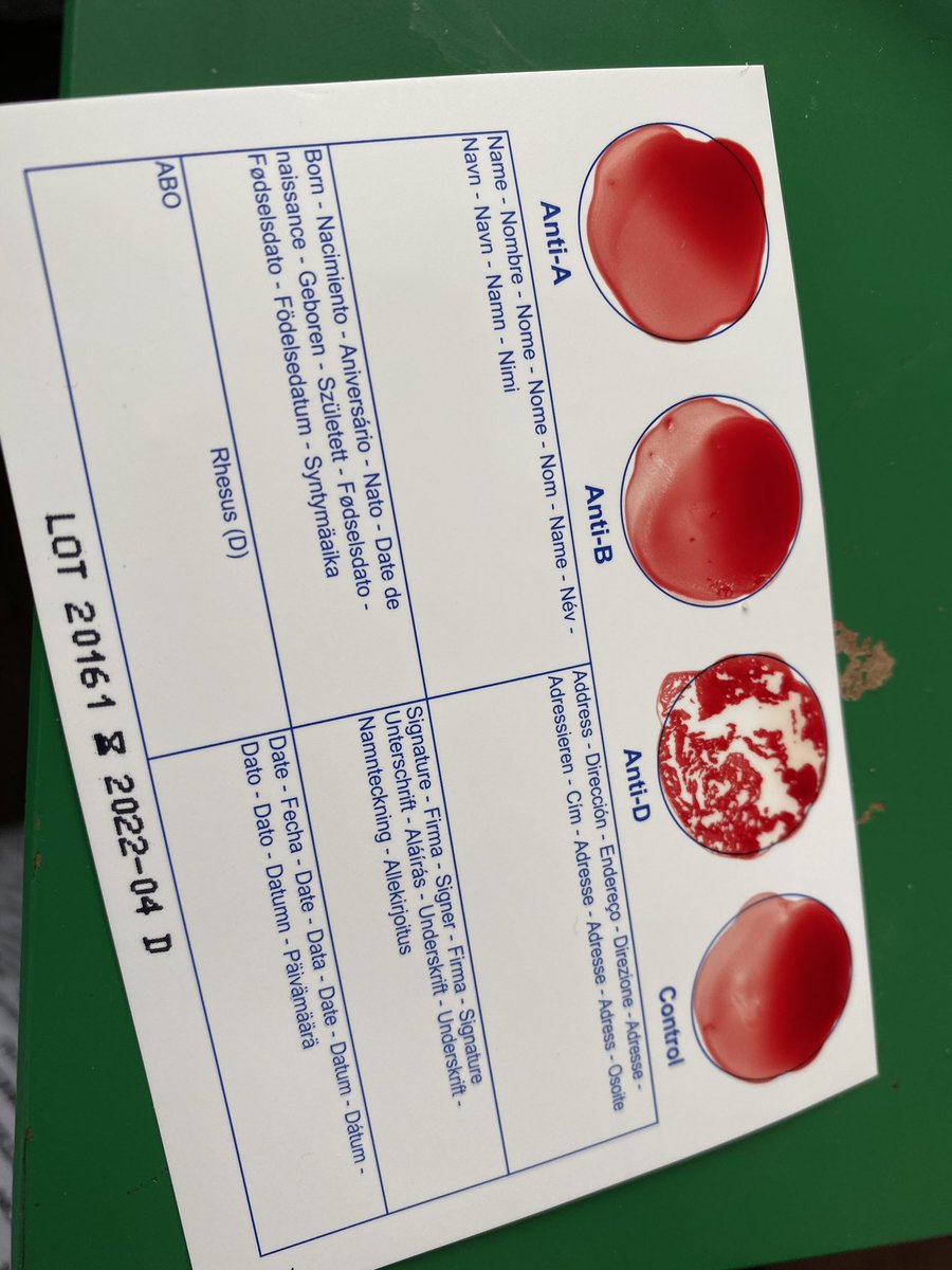 LadySnowBubbles's tweet photo. A bit of science in the Snowball household today . The boys learnt about blood groups and RH factors when we did their dads (night shift amazon buy 😂) O pos - the same as me so at least the boys know what they are now 👍🏻@Neil_McAvoy @ClaveringTS27 https://t.co/U5uuPQLGqQ