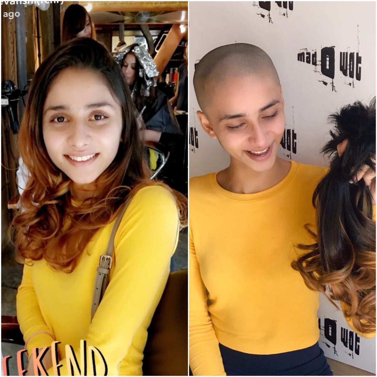 HumansOfBombay's tweet photo. "A few days later, she walked into my room–she’d completely shaved off all her hair and was bald...just like me. I cried, ‘Aayushi!’ in disbelief and asked her why she did that, and then broke down. She ran over and hugged me tight and we cried together."

https://t.co/eTOZ5cbiMN https://t.co/A4gk0x5Dpp