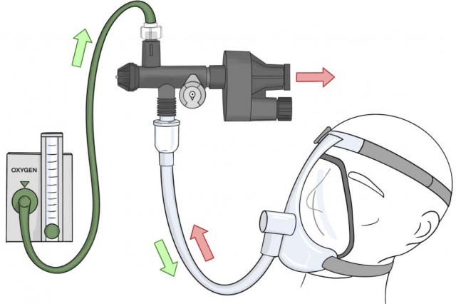 "even when there seems to be an urgent need, simply providing resources without considering the local context is rarely the right approach"

#philanthropy wisdom in Jon Fielder <a href="/AfricaMHF/">AMH</a> article: "DON'T SEND VENTILATORS"

campaign.r20.constantcontact.com/render?m=11036…