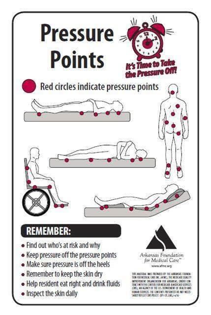 TriumphOverSCI's tweet photo. An informative diagram for those dealing with paralysis; remember where your pressure points are and offload pressure often to prevent pressure ulcers.#TriumphFoundation #TriumphOverSCI https://t.co/wzEdMAdoPz