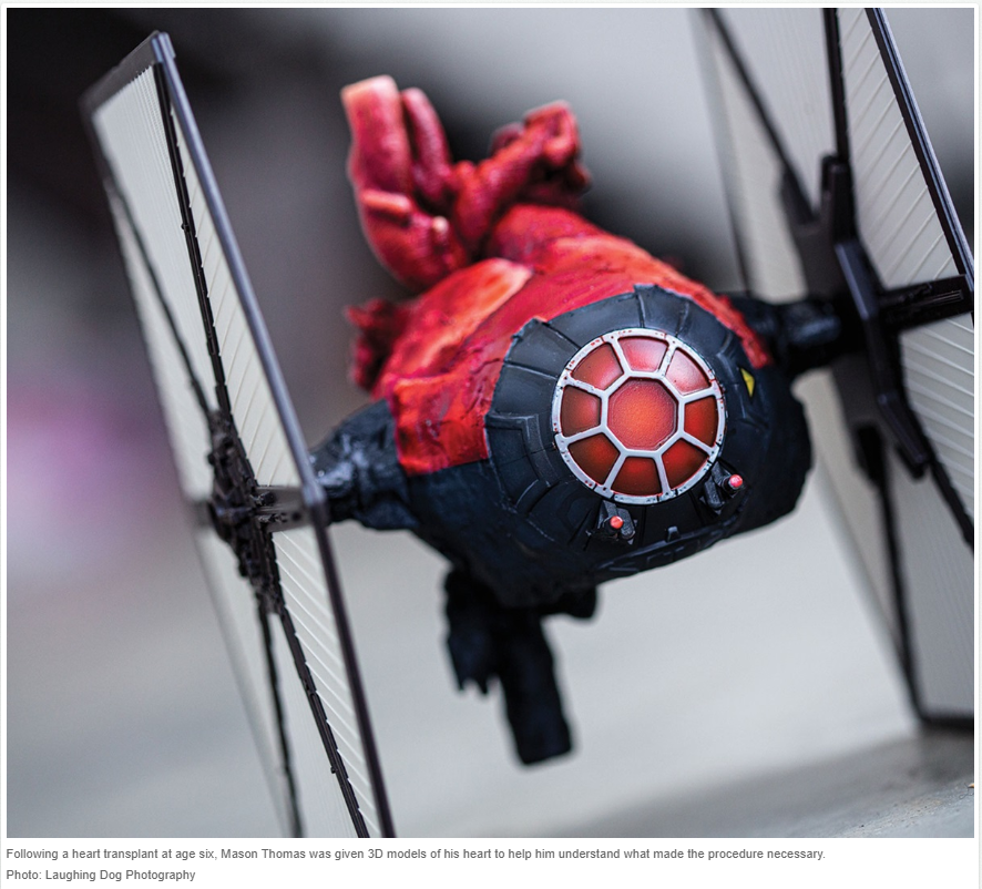 Lyn Sonnenberg π¨π¦ (@lynsonnenberg) on Twitter photo Awesome work by the whole team <a href="/AcTech_FoMD/">AcTech_FoMD</a>
to bring this heart to life and take flight!
<a href="/CodyWesley8/">Cody Wesley</a> you really went above and beyond. Thank you. #3DHeart #TIEFighterHeart <a href="/charlesplarson/">Charles Larson</a> Awesome work by the whole team <a href="/AcTech_FoMD/">AcTech_FoMD</a>
to bring this heart to life and take flight!
<a href="/CodyWesley8/">Cody Wesley</a> you really went above and beyond. Thank you. #3DHeart #TIEFighterHeart <a href="/charlesplarson/">Charles Larson</a>