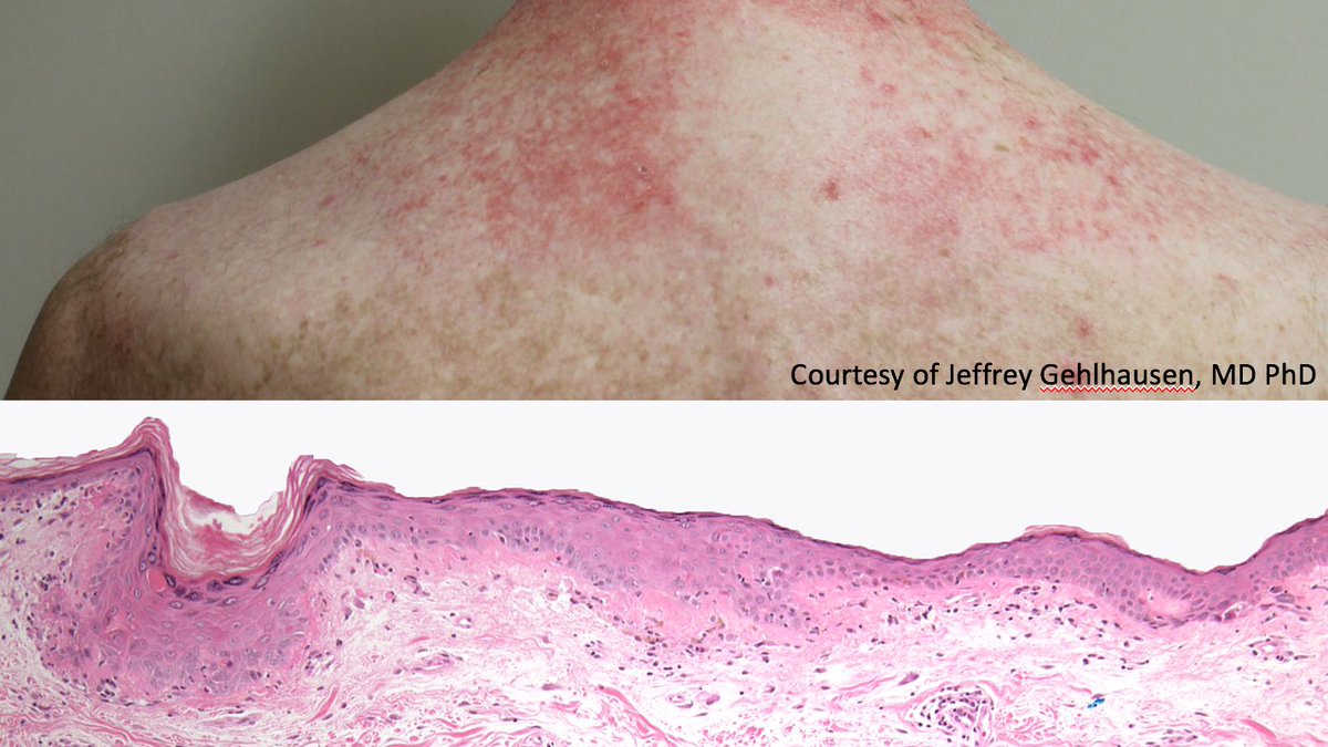 Christine J. Ko, MD tweet media