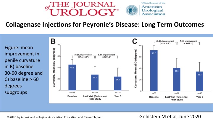 What happens after extended follow-up in men treated w/collagenase injections for #Peyronies Disease? 
Goldstein et al performed an extension trial of pts from 4 RCTs &amp; found additional improvements in curvature response w/o additional treatments.
[ow.ly/ACWW50zQLhN]