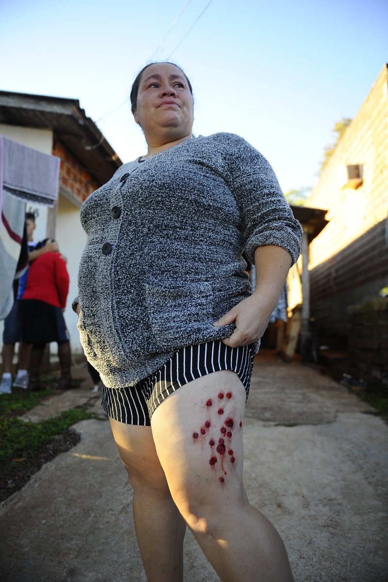 LAJEADO | Três mulheres foram atingidas por disparos de borracha efetuados pela Força Tática

informativo.com.br/policia/morado…