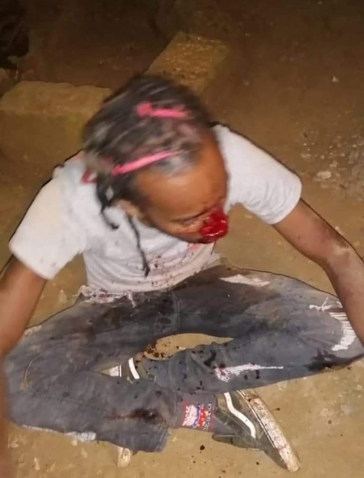 The police also stole his phone and money and left him to bleed to death.  @NziokaWaita pass this to your boss.  @RailaOdinga is there anything to be happy about here?   #EndPoliceBrutality