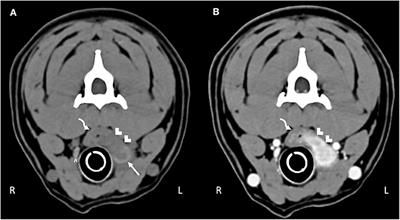 Albinovet's tweet image. #coccidioides posadasii in a dog with cervical dissemination complicated by esophageal fistula.CT revealed a communication of the draining tract with the esophagus along with enlargement of the left lateral &amp;amp; medial retropharyngeal,&amp;amp; mandibular lymph nodes buff.ly/2TMJt58