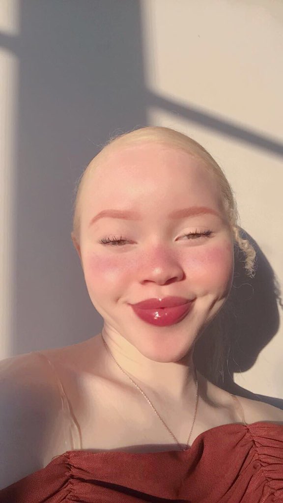 techgeekafrica's tweet photo. Albinism is beauty ❤️❤️🔥🔥🔥 https://t.co/ZsqsYJ5eOL