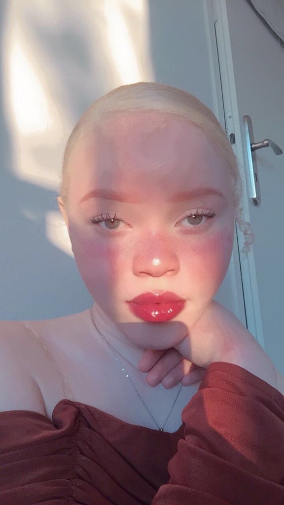 techgeekafrica's tweet photo. Albinism is beauty ❤️❤️🔥🔥🔥 https://t.co/ZsqsYJ5eOL