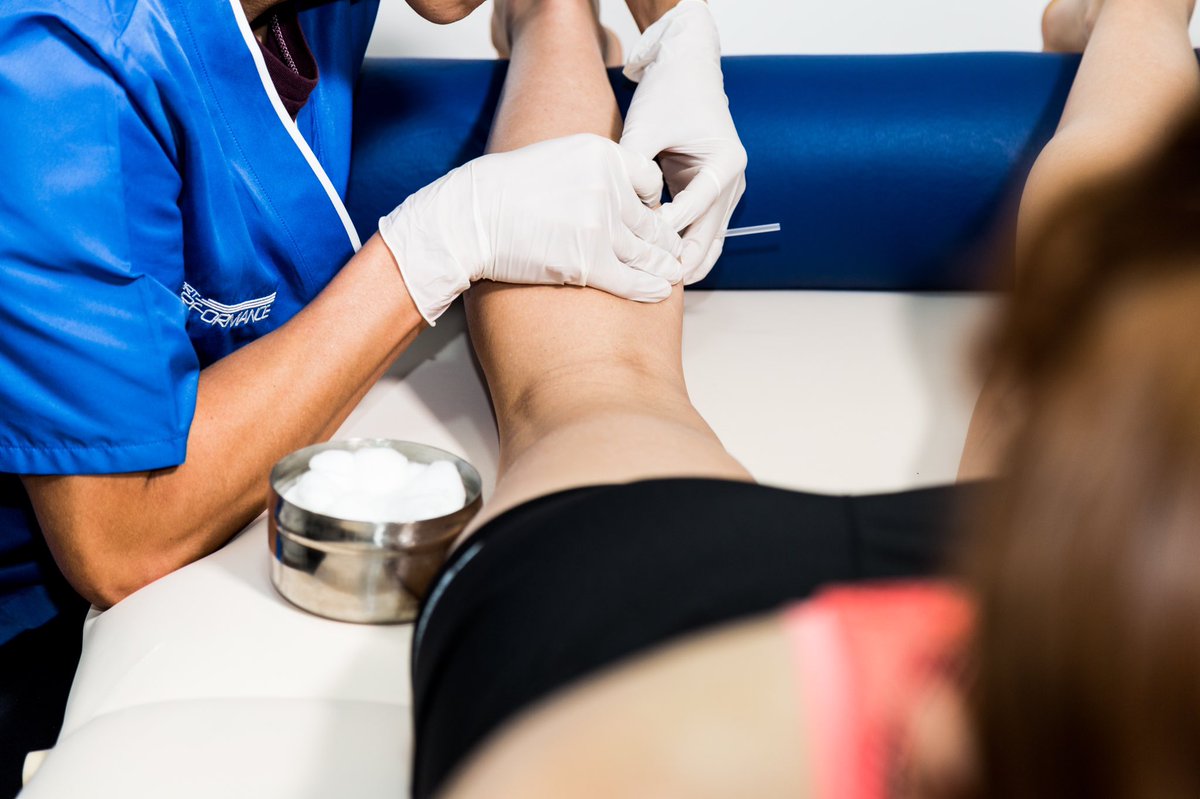 SportPerform_MX's tweet photo. 📍PUNCIÓN SECA 👇

🎯 Intervención terapéutica utilizando una aguja tipo acupuntura para penetrar en la piel que estimula los puntos gatillo miofasciales, la musculatura y el tejido conectivo para el tratamiento de los trastornos dolorosos neuromusculoesqueléticos. https://t.co/kUYOPlADdx