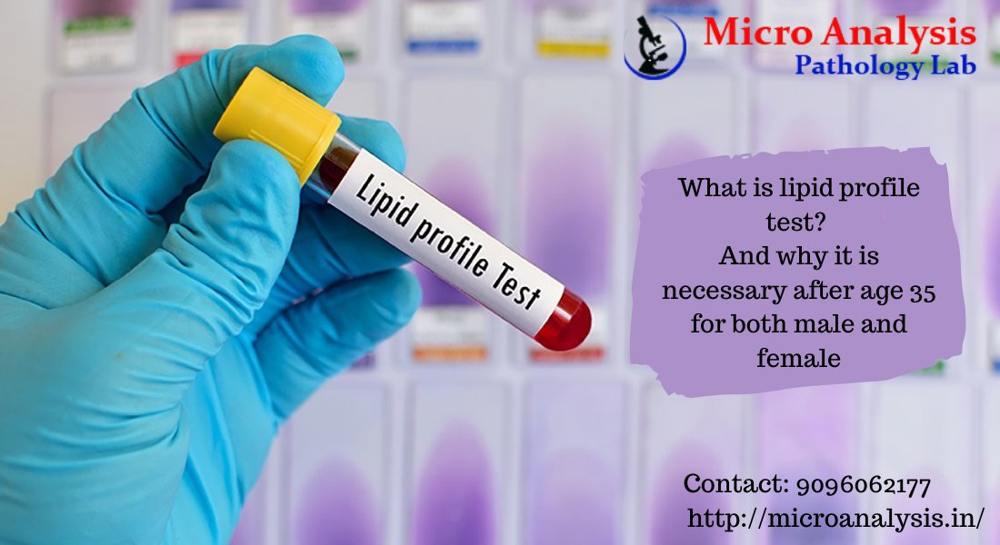 PahologyLab's tweet photo. Lipid Profile
MAPL
090960 62177
https://t.co/8aBndqrppd
To know more visit here:- https://t.co/JIuQuNqoHo
#lapid #z #israel #israeliceramics #ceramic #mcm #midcenturymodern #midcentury #pottery #manicure #design #english #efl #nadav #instalearning #onlineschool #nacre #Lockdown5 https://t.co/gc4OnIUY6b