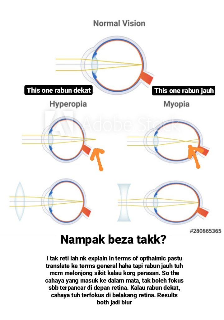 Okay bismillah. I've made some videos on my igstory (@/faghahdieannaa) if you gais nak dgr i explain panjang lebar haha but i'll type in a simpler version here.So basically, rabun nie ada dua jenis. Satu rabun jauh (myopia), another one is rabun dekat (hyperopia)