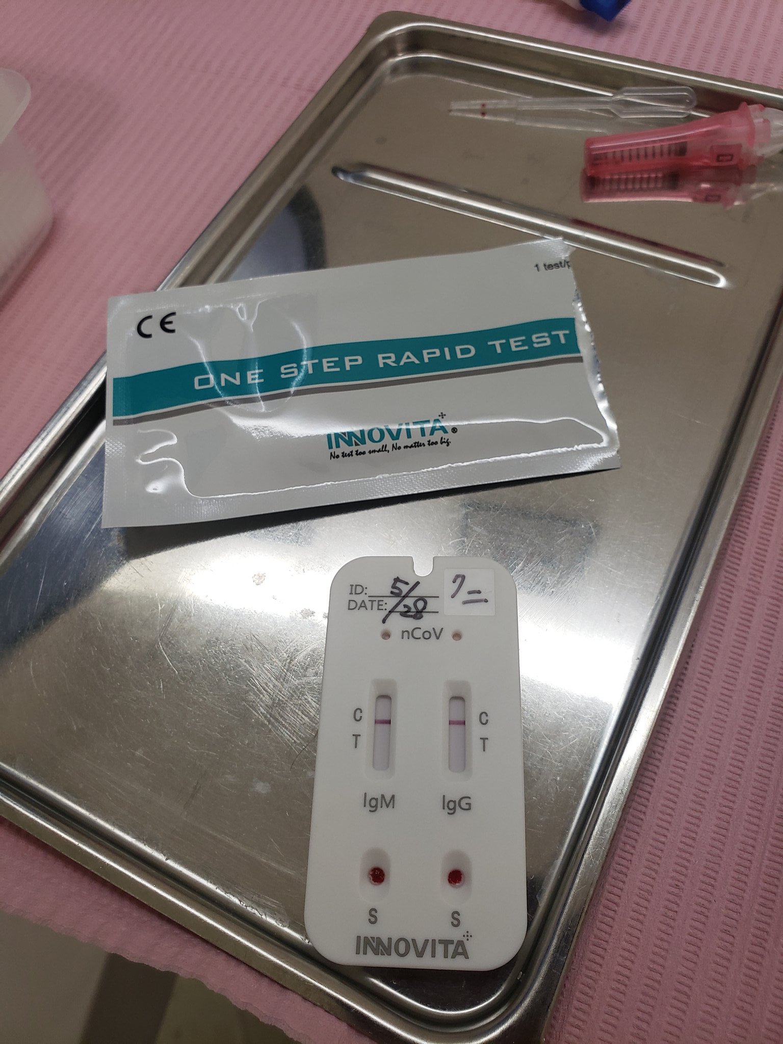 清水邦広 数日前から歯が痛かったので 歯医者に行き コロナの抗体検査が出来たので やっていただきました 時間は15分で簡単にでき 結果は陰性 緊急事態宣言が解除されても コロナ対策を忘れずに こまめな手洗い うがい マスク 消毒 ３密 移さない 移らない