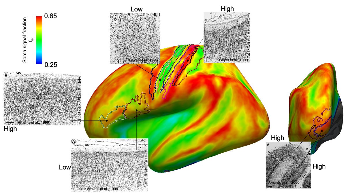 And we demonstrated the potential value of SANDI to characterise the brain cytoarchitecture with more specificity to soma density, in-vivo in 25 healthy human subjects from the  @MGHMartinos Adult Diffusion Dataset. (7/9)