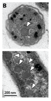 Carboxysomes: check. Shout out to  @cblikstad for so much help with the EM.