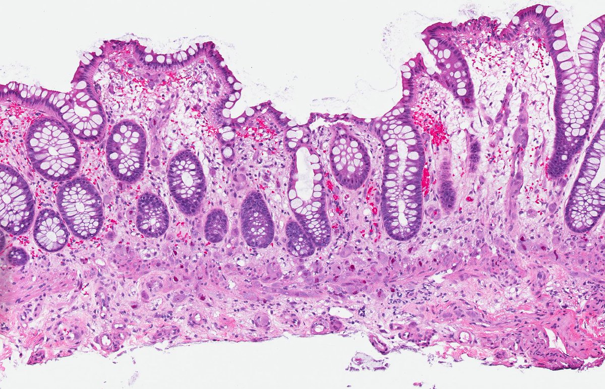 RhondaYantiss's tweet image. Well, hello there! @TheUSCAP @USGIPS