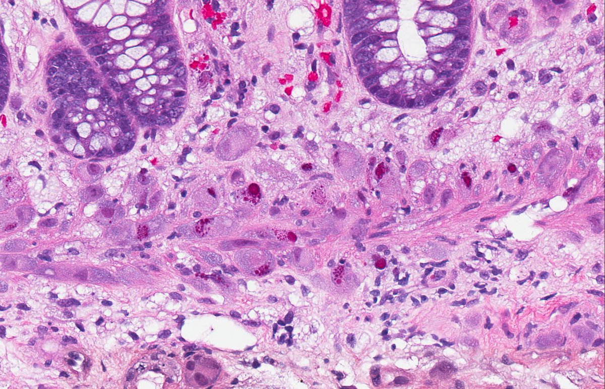 RhondaYantiss's tweet image. Well, hello there! @TheUSCAP @USGIPS