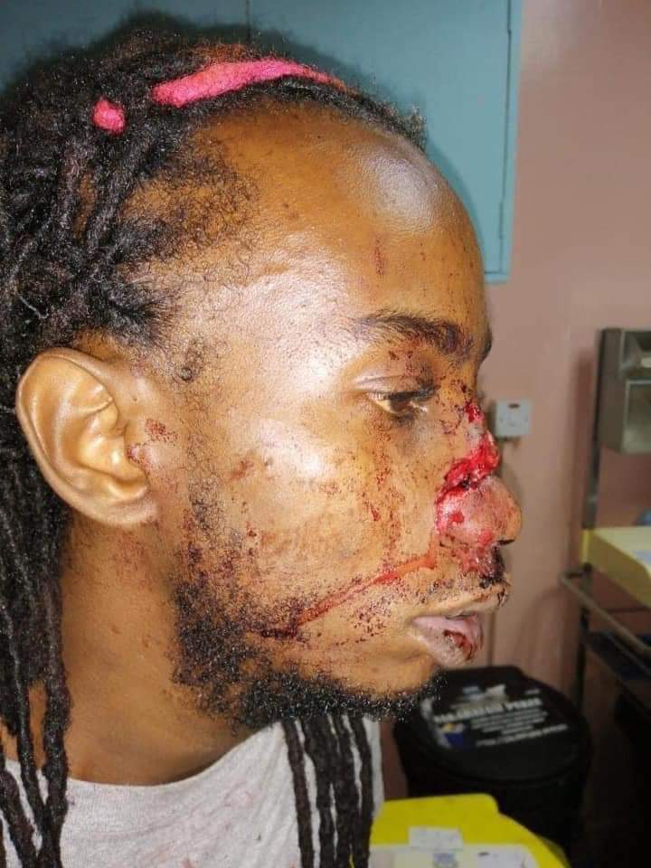 VeejayMarshall's tweet photo. Now we have to worry about COVID19, hunger, Curfew, poverty and police brutality??? Come'on give us a break @WanjiruNjeri4 @antonios_sir @SAMMIELOGY @InsecurityKE  @NiiteForest @patohmwai https://t.co/oqrn9MtJI2