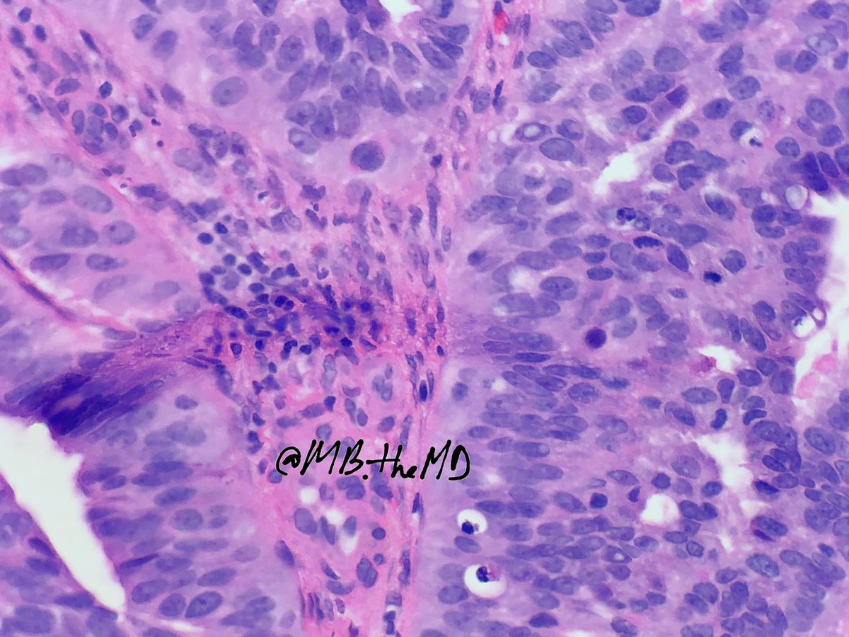 MB_thepathMD's tweet photo. #pathology #pathologists #PathArt #gynpath https://t.co/6crz4QdF6W