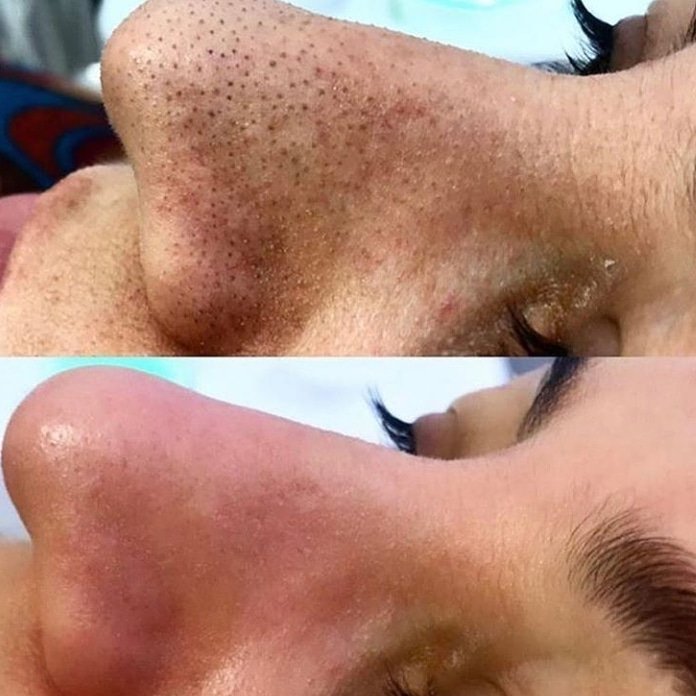BeautyLifeCent1's tweet photo. Sağlık Bakanlığı’ndan ruhsatlı onaylı
 4 mevsimuygulana bilen ciyazımizla sizlerin hizmetindeyiz  Lazer Epilasyon
Kirpik lifting 
BEAUTY  LIFE CENTER 

Detaylı bilgi &amp; Randevu için
☎️054157025 79☎️

#lazer #epilasyon #lazerepilasyon #lazerepilasyonantalya #antalya  #antalyalazer https://t.co/ggcuB35JHZ