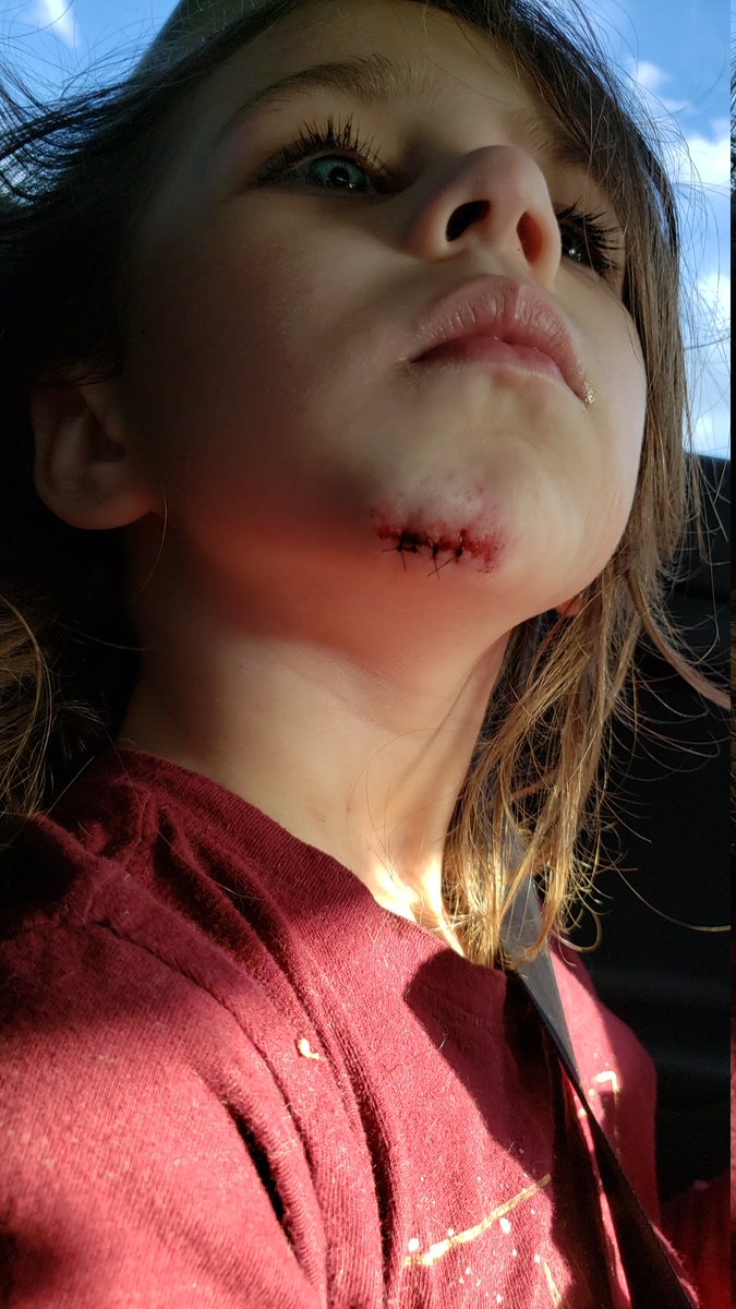 SpencerTLove's tweet photo. Oof what a rough night. My poor baby got her first set of stitches. My heart hurts. #bravegirls #whatatrooper https://t.co/Pu2fNG6JmU