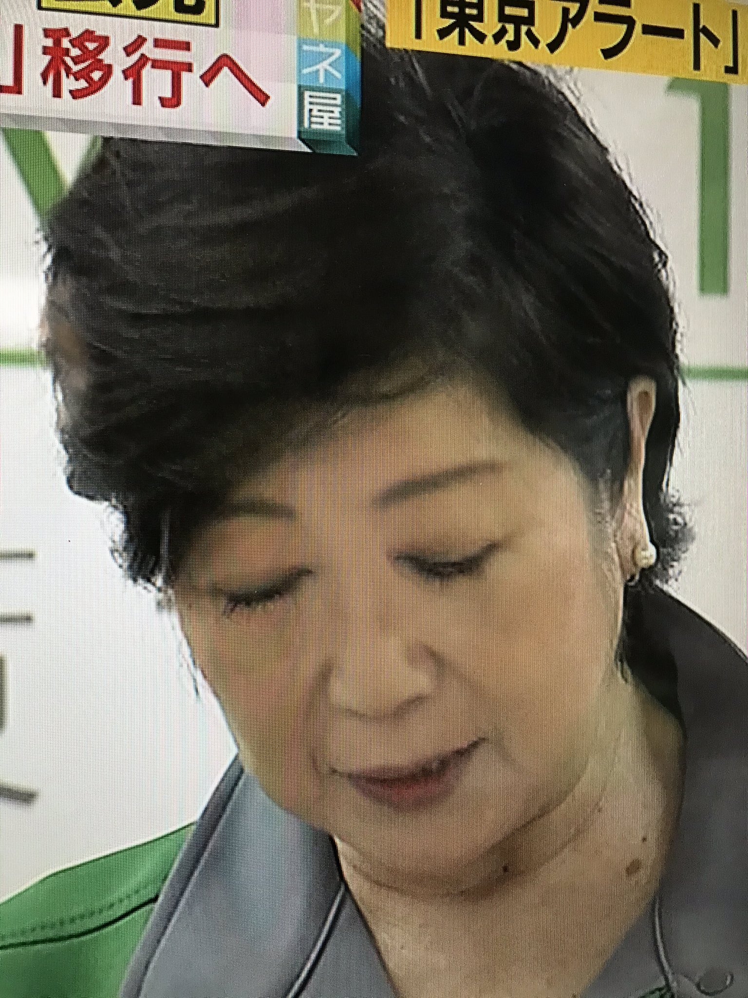 小池 知事 目の下