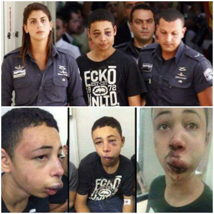 charlie_mouton's tweet photo. Enfant prisonnier palestinien Tariq Abu Khudair lors de sa présentation au tribunal avec des signes de torture sur son visage. Si cette enfant était dans un autre pays,toutes les organisations qui revendiquent les droits de l'homme  auraient parlé de lui et de ses droits https://t.co/o4ejOyrlas