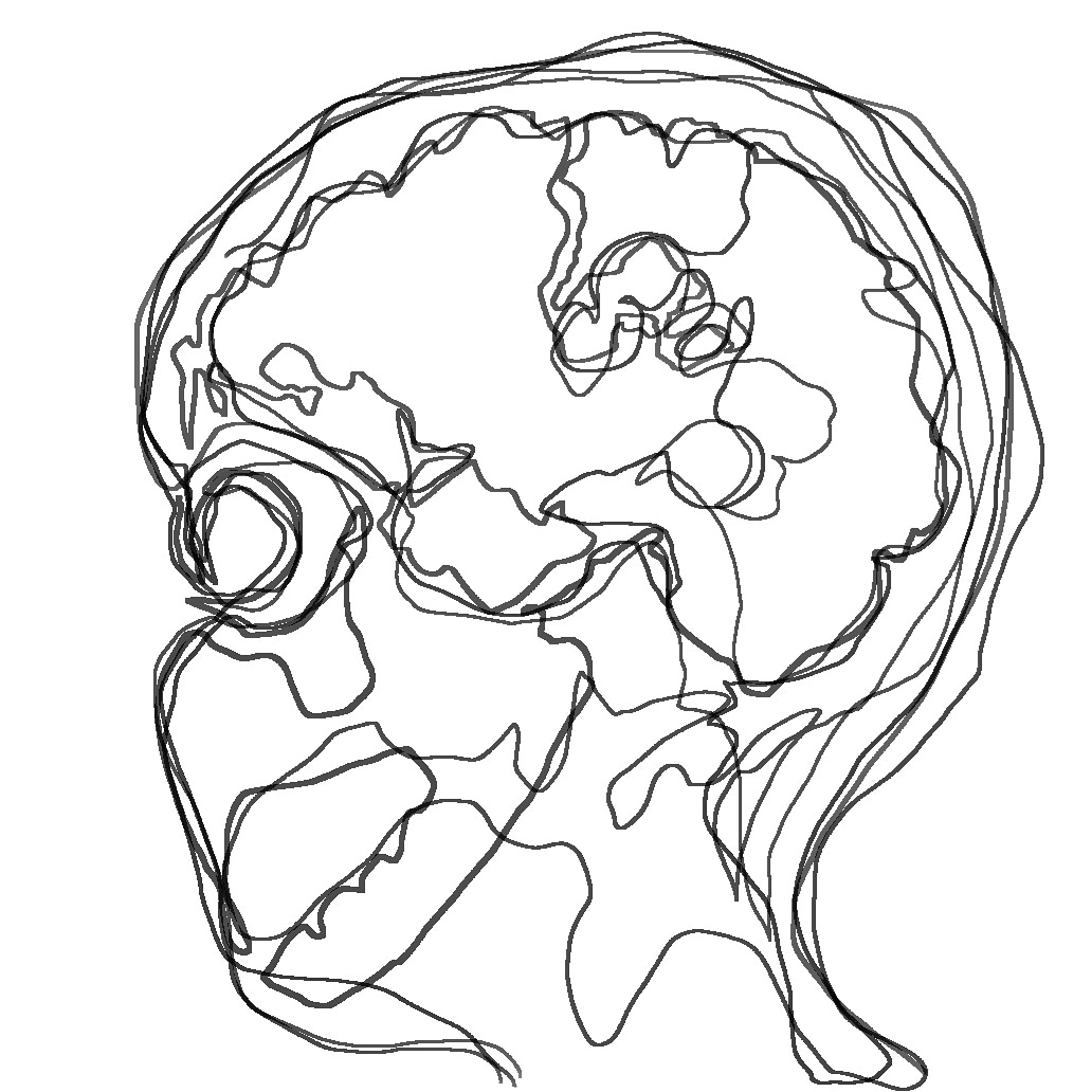 charcotstudio's tweet image. I&apos;ve been working on a little something for @WorldMSDay which is...TOMORROW! 🤪
It is all coming together &amp;amp; will be shared oh so soon!
In the meantime here is a development shot...#workinprogress !
🧠💕
#charcotstudio #makingMSvisible #redesigning #MRIscans #digitaldesign