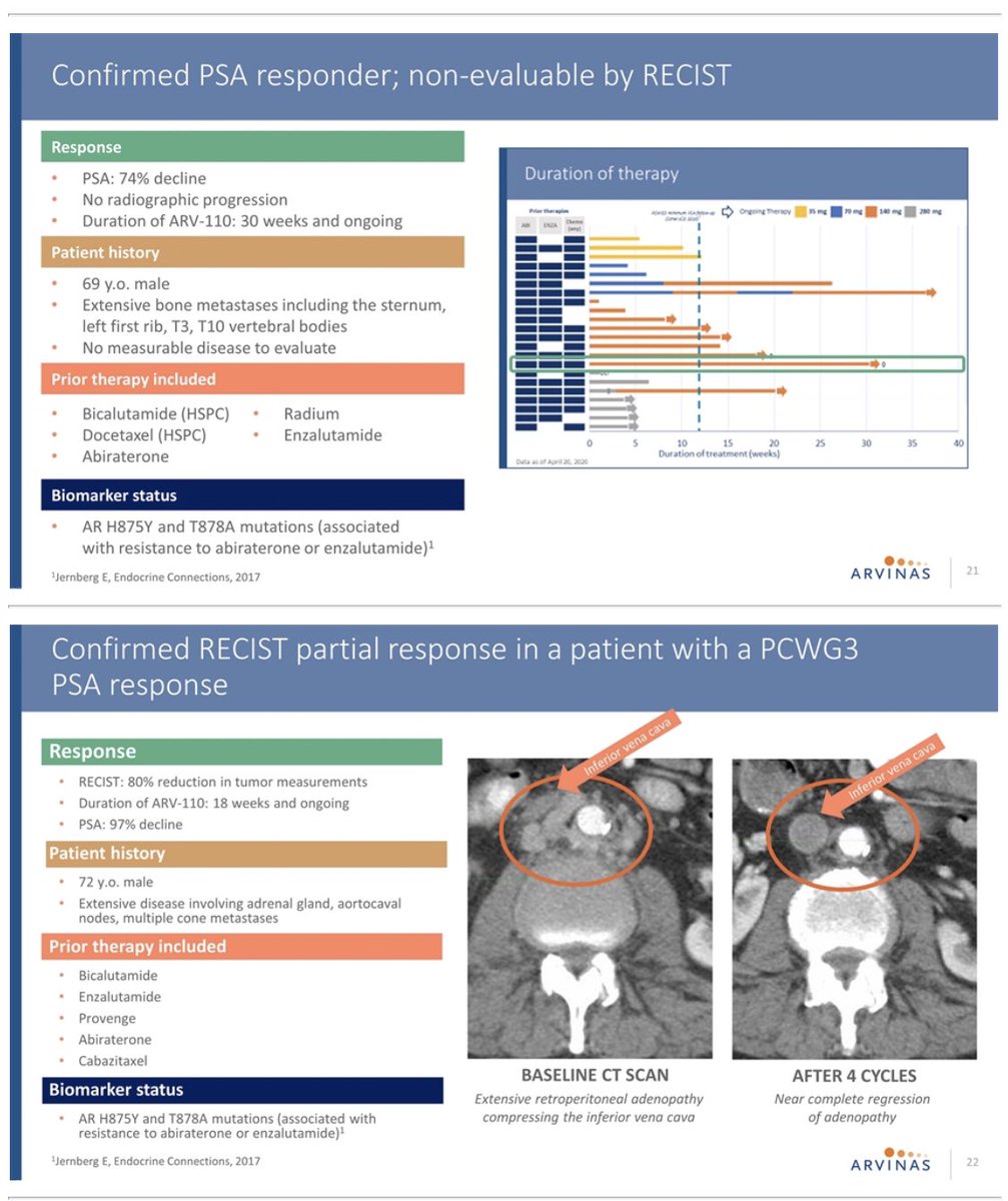  $ARVN no additional responses from abstract, denominator goes up to 22. 2/20 responses for 10% PSA50 response (for evaluable patients)PR and deck don’t mention anything about AR degradation No info on PSA baseline either  https://twitter.com/pogcat1714/status/1260707067796631552