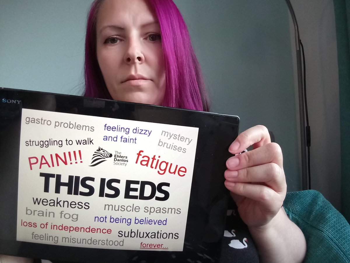 This is Ehlers Danlos Syndrome #thisiseds #myEDSchallenge #EhlersDanlosSyndrome #EDS #ehlersdanlos #hsd #jointhypermobility  @TheEDSSociety