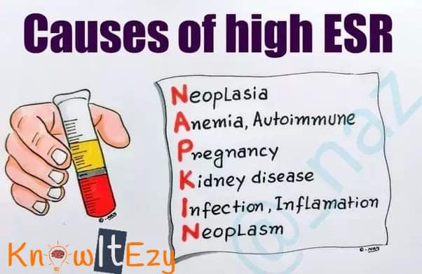 Mnemonics play a big role in memory enhancement