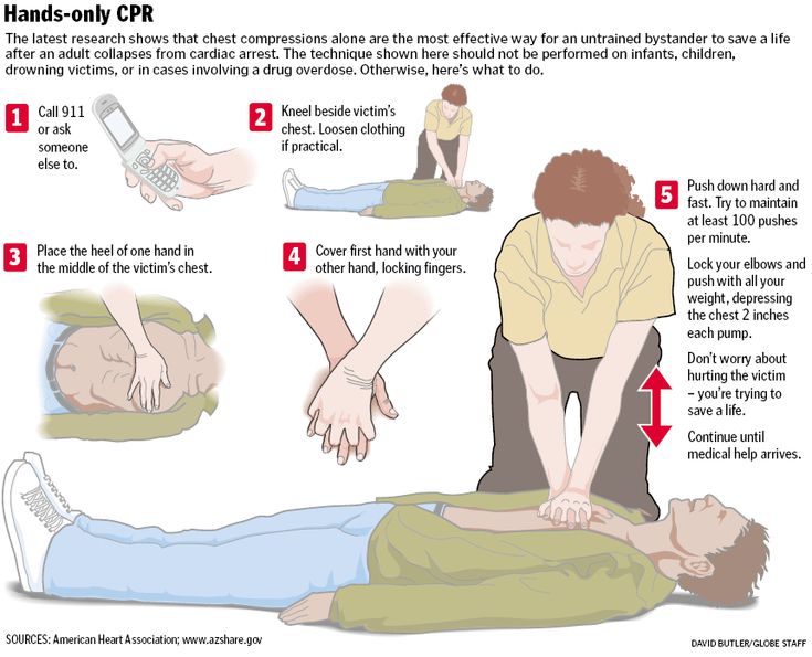 DOING CPR: use all your weight to compress their chest and push using your shoulders, not bending your arms. make sure their chest goes down as much as possible with each compression and wait for it to rise on its own before starting the next one