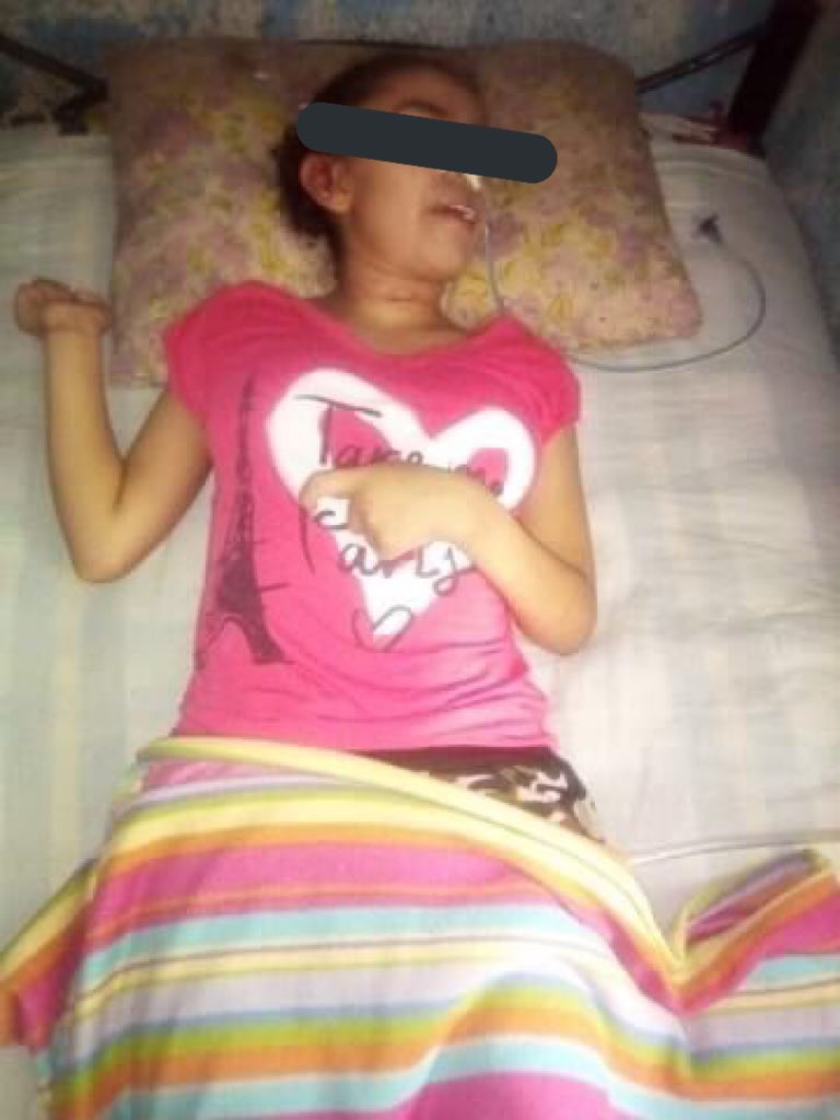 brujasdelmar's tweet photo. Alejandra de 20 años, el 29/02/20 Brandon Illescas la drogó con altas dosis de diazepam y la dejó convulsionando en la calle. La trasladaron al hospital, estuvo 6 semanas en terapia intensiva, tiene daños cerebrales permanentes. Sigue impune y sin apoyo. Esto en Milpa Alta, CDMX. https://t.co/LkCTZ0jVDi